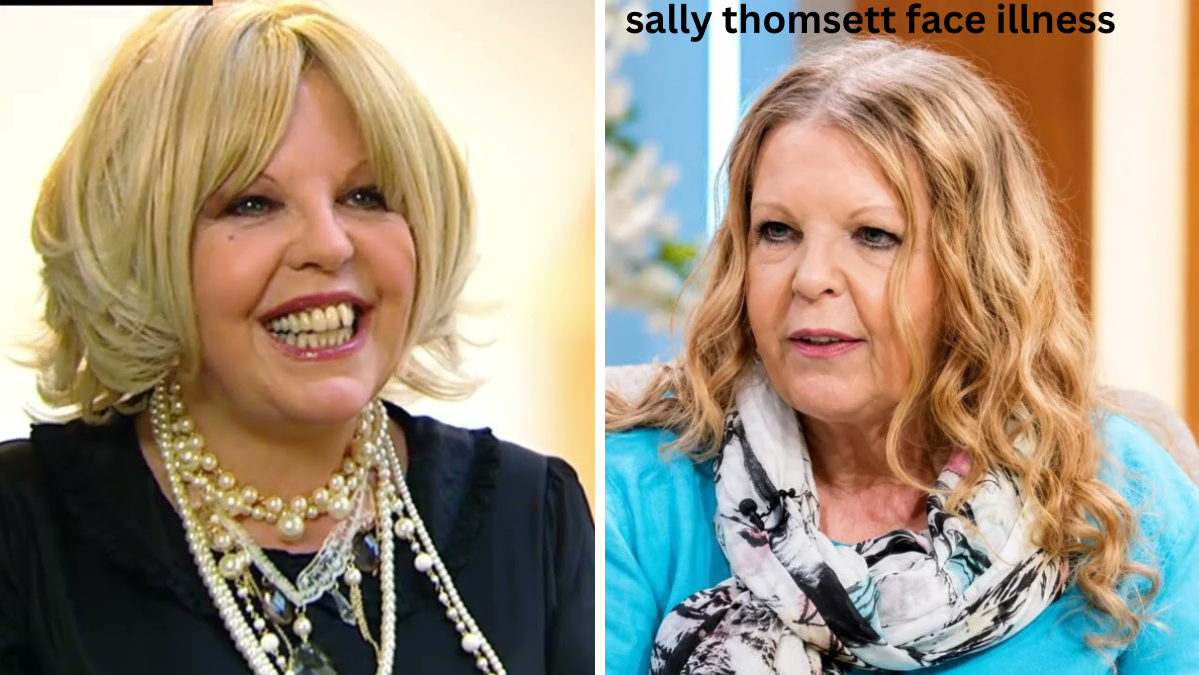 Adin Ross Sister Sally Thomsett Face Illness